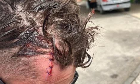 This is the least upsetting photograph provided by the mother who has lodged complaints. The others, showing head swelling, were too graphic to use without potentially causing people distress