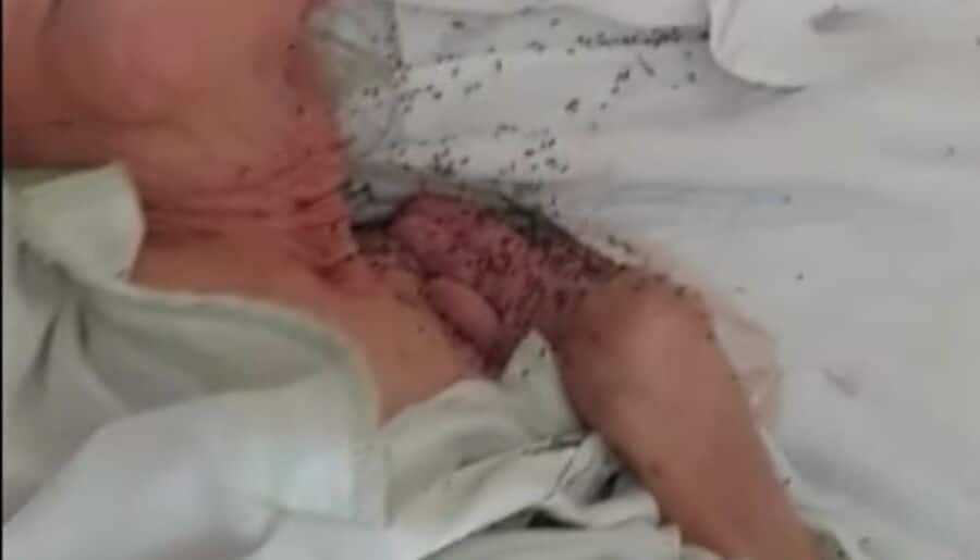 Shock as woman filmed covered in ants at Algarve nursing home|Shock as woman filmed covered in ants at Algarve nursing home