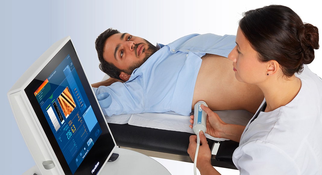 Fibroscan® a non-invasive way of predicting hepatic steatosis