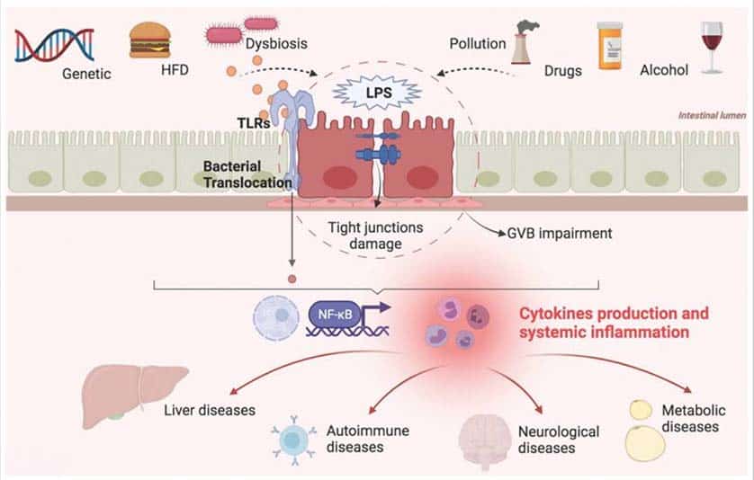 Fig 1: Factors contributing to intestinal barrier impairment and systemic diseases. HFD: high fat diet; LPS: lipopolysaccharide; GVB: gut vascular barrier; TLRs: toll-like receptors. Ref: Int. J. Environ. Res. Public Health 2021 Dec; 18(23): 12836.