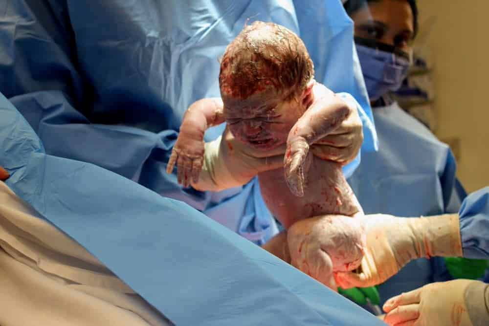 Almost 65% of births in private hospitals are by cesarean section