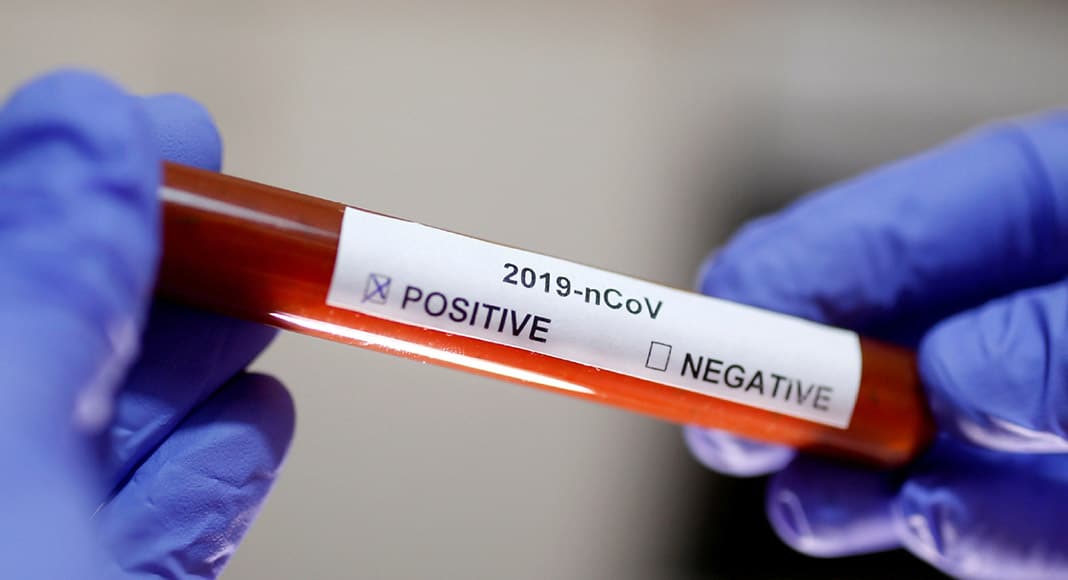 coronavirus