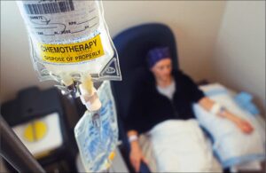 Study offers structured post-Covid recovery plan for cancer response