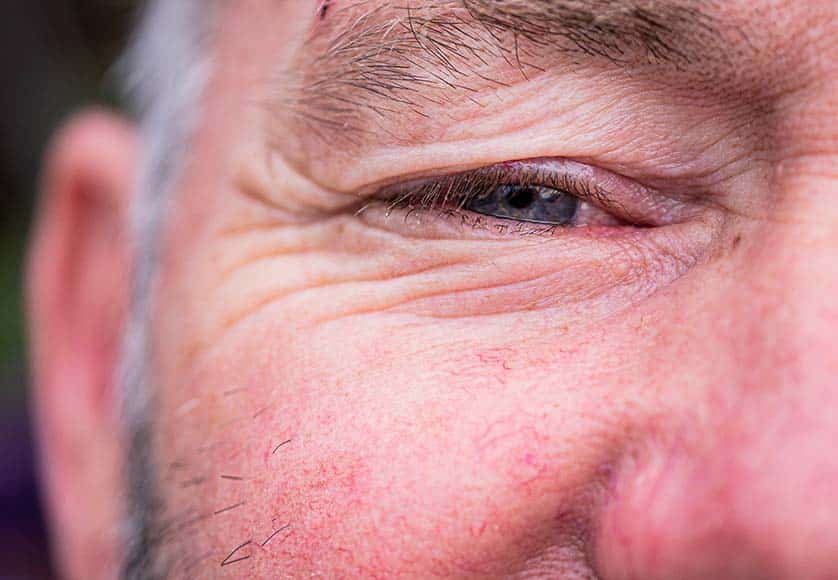 eye close up