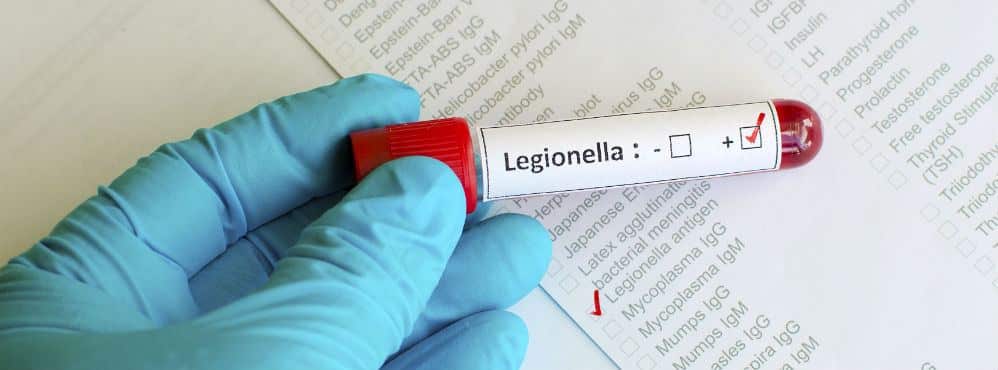 legionella3.jpg