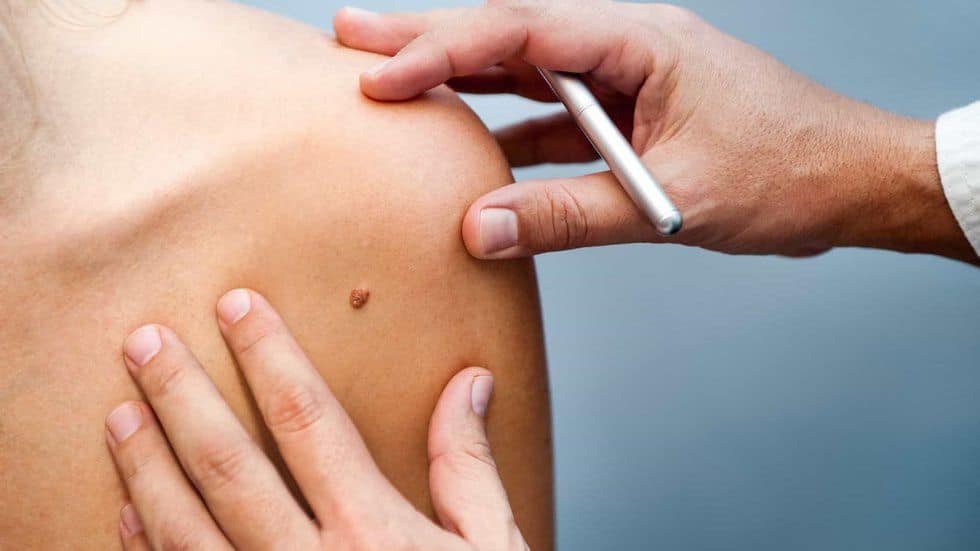 dermatology diagnosis