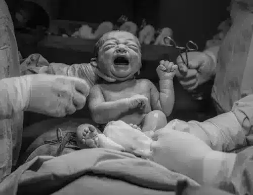 General surgeons to be called in to perform cesarean sections