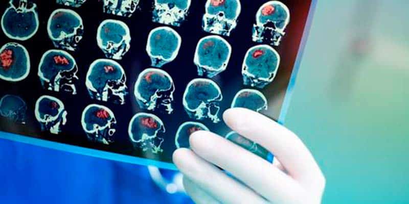 CHUA wins Angels Initiative platinum award for stroke care in the Algarve