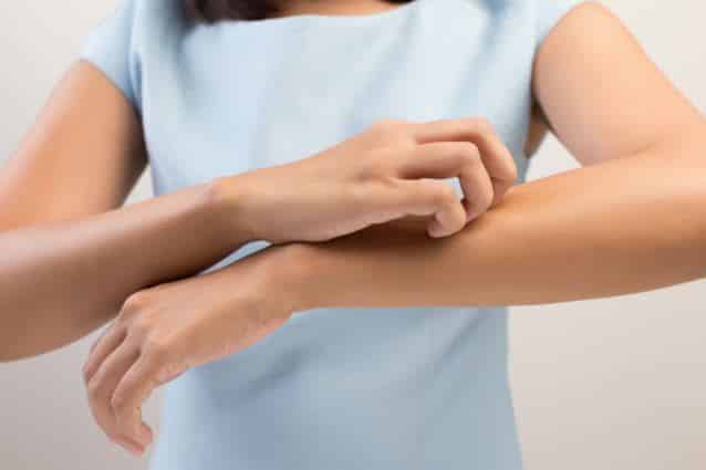 woman-itchy-skin.jpg