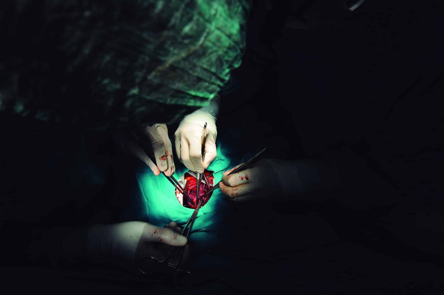 Pediatric heart surgery, close-up