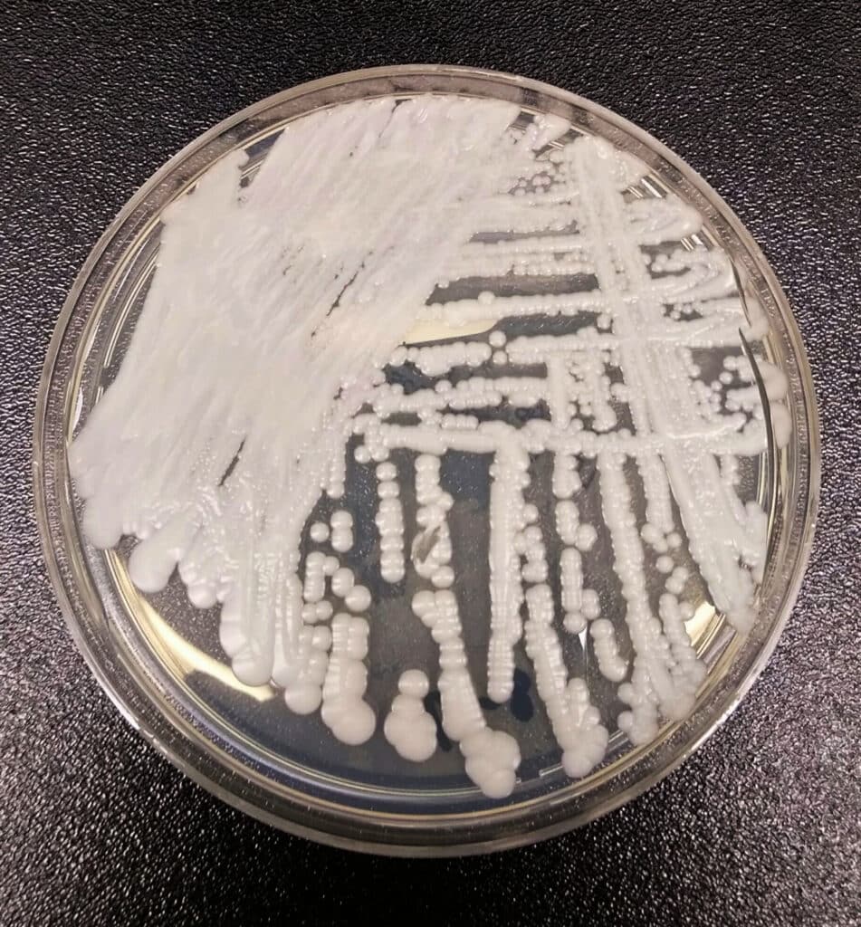 Drug-resistant fungus detected in Portugal for first time